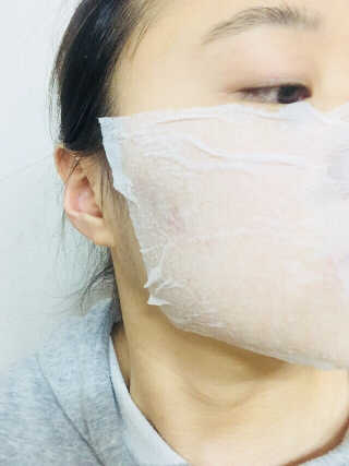 나이팅게일 광채토너130ml+더마 드레싱 코튼 100 SET — 5점을 준 리뷰어가 2018년 5월 올린 사용 사진
