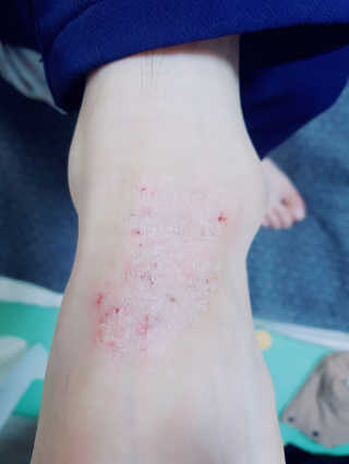 언제나피터팬님이 올린 리뷰 사진 2