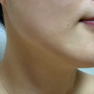 (주)에네스티 미스랩 갈락토미세스 클리어 플러스 에센스 — 5점을 준 리뷰어가 2020년 2월 올린 사용 사진