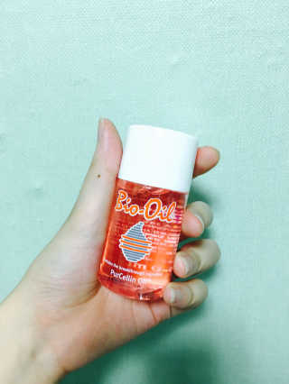 Bio-oil(바이오오일) 바이오오일 — 5점을 준 리뷰어가 2016년 10월 올린 사용 사진