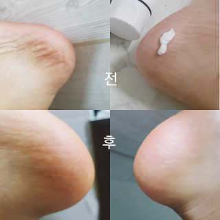 (주)에네스티 에네스티 수안수 실크스킨 풋크림 1+1 — 5점을 준 리뷰어가 2019년 11월 올린 사용 사진