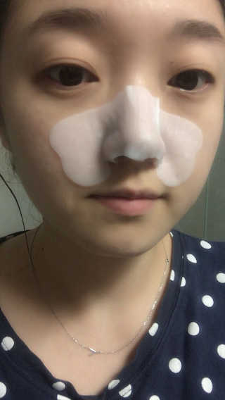 나이팅게일 TAKO PACK NOSE [문어코팩] — 4점을 준 리뷰어가 2017년 3월 올린 사용 사진