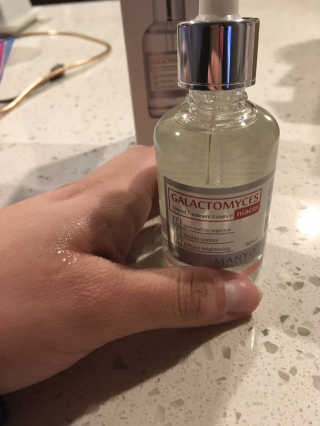 [마녀 공장] 발가락 토미 니아신 에센스 50ml — 5점을 준 리뷰어가 2019년 1월 올린 사용 사진