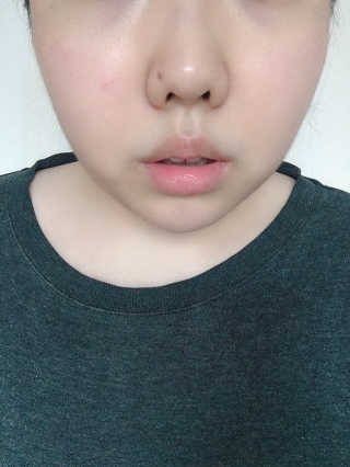 스케덤 시카 리프팅밴드 — 3.5점을 준 리뷰어가 2019년 3월 올린 사용 사진