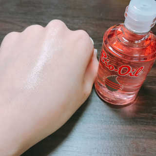 Bio-oil(바이오오일) 바이오오일(Bio-oil) — 4점을 준 리뷰어가 2017년 2월 올린 사용 사진