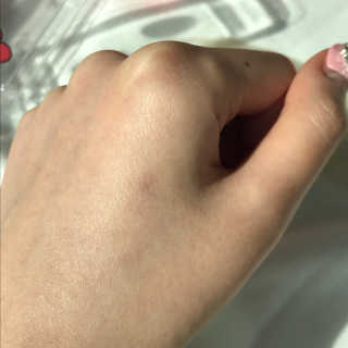 캐치미패치 트러블 스팟패치 — 4점을 준 리뷰어가 2020년 2월 올린 사용 사진