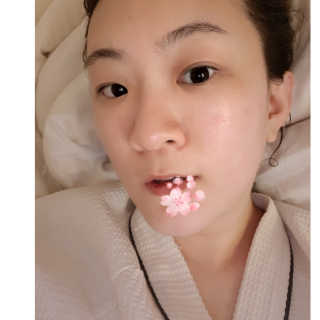 셀레뷰 슈퍼 모이스처 수딩젤 — 4.33점을 준 리뷰어가 2018년 3월 올린 사용 사진