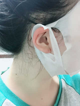 더메이런 듀얼 이펙트 스트레치 리프팅 마스크 — 3.5점을 준 리뷰어가 2017년 1월 올린 사용 사진