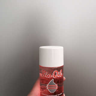 Bio-oil(바이오오일) 바이오오일(Bio-oil) — 4점을 준 리뷰어가 2016년 12월 올린 사용 사진