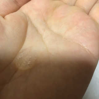 (주)에네스티 믹스베리 단백질 폭탄 샴푸 1000g — 4.5점을 준 리뷰어가 2020년 1월 올린 사용 사진