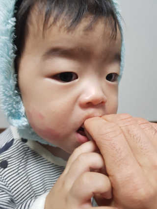 라이프스토리 어린이영양제 면역튼튼 — 5점을 준 리뷰어가 2017년 11월 올린 사용 사진