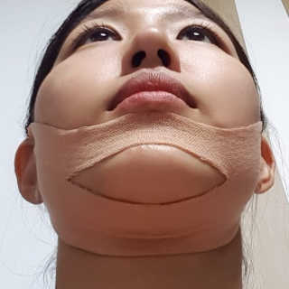 아이디플라코스메틱 아이디 페이스핏 마이너스 밴드 — 5점을 준 리뷰어가 2019년 9월 올린 사용 사진