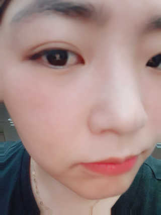 ROSE BLANCHE 로제블랑쉐 인텐시브 수딩 세럼 — 5점을 준 리뷰어가 2019년 7월 올린 사용 사진