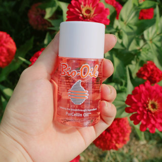 Bio-oil(바이오오일) 바이오오일(Bio-oil) — 4점을 준 리뷰어가 2016년 8월 올린 사용 사진