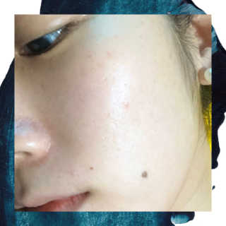 메디필 허벌 필 톡스 — 5점을 준 리뷰어가 2020년 3월 올린 사용 사진