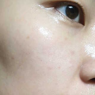 [더메디닥터] 이데베논 클렌징 무스 — 5점을 준 리뷰어가 2019년 9월 올린 사용 사진