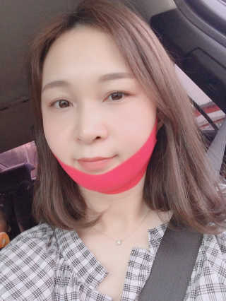 스케덤 펩타이드 리프팅밴드 — 5점을 준 리뷰어가 2019년 3월 올린 사용 사진