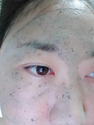 글랜무어 디톡 제올라이트 클리어링 버블 팩 — 5점을 준 리뷰어가 2018년 5월 올린 사용 사진
