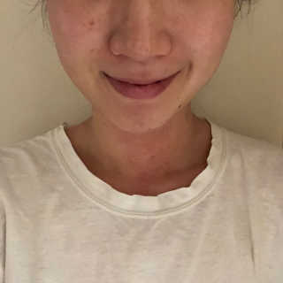 블랙모어스 내츄럴 비타민 E 크림 — 5점을 준 리뷰어가 2018년 3월 올린 사용 사진