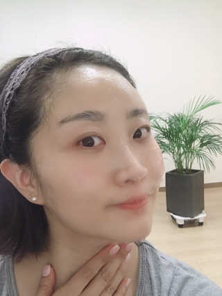 메디타임 멜라반 더마 토닝 씬젤 — 5점을 준 리뷰어가 2019년 6월 올린 사용 사진