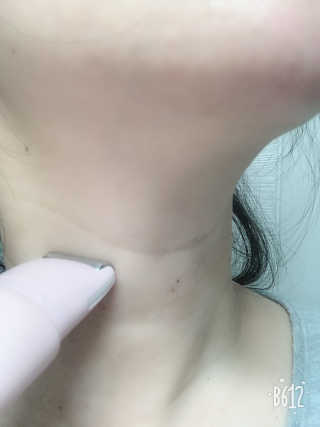 서연이맘님이 올린 리뷰 사진 4