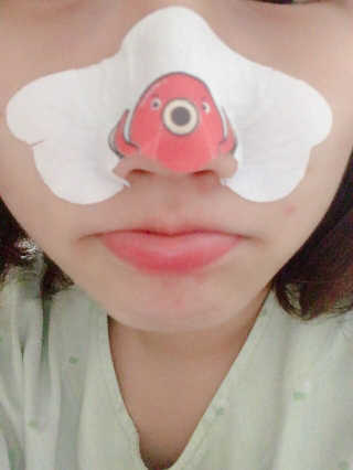 나이팅게일 TAKO PACK NOSE [문어코팩] — 3점을 준 리뷰어가 2017년 9월 올린 사용 사진