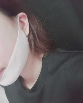 스케덤 클루덤 리프팅 패치 — 4점을 준 리뷰어가 2019년 4월 올린 사용 사진