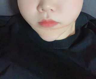아이디플라코스메틱 아이디 페이스핏 마이너스 밴드 — 4점을 준 리뷰어가 2019년 11월 올린 사용 사진