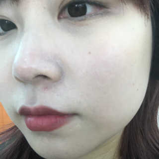 라임코스메틱 V 콜라겐 앰플 쿠션 — 1점을 준 리뷰어가 2020년 1월 올린 사용 사진