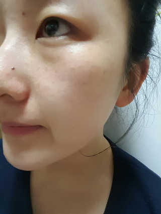 보타니티 [홍]조[진]정[결]케어 플라본 세럼 — 4점을 준 리뷰어가 2018년 5월 올린 사용 사진