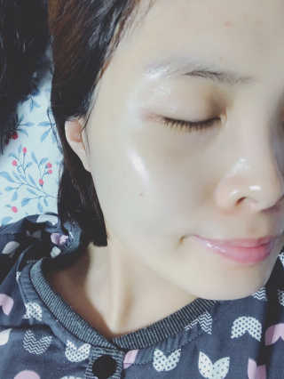 브이테라D 더마엘라비에 브이테라 D 발효 허니부쉬 에센스 — 5점을 준 리뷰어가 2019년 5월 올린 사용 사진