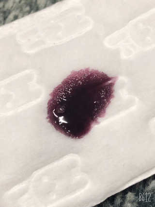 쏘내추럴 레드 필 팅글 세럼 오리지널 — 5점을 준 리뷰어가 2019년 8월 올린 사용 사진
