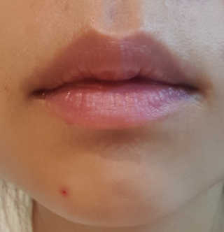 [후르디아] 블루베리 과즙 듬뿍 꿀과즙립밤 3개 세트 — 4점을 준 리뷰어가 2019년 11월 올린 사용 사진