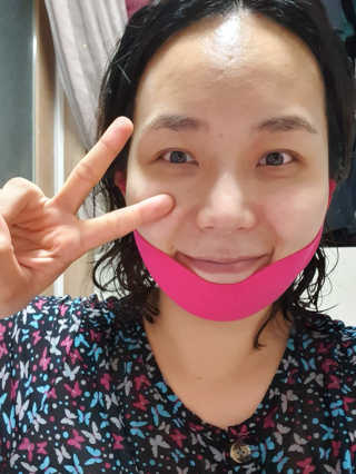 스케덤 펩타이드 리프팅밴드 — 4점을 준 리뷰어가 2019년 7월 올린 사용 사진