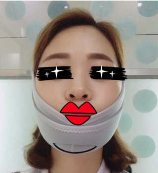 메디미 브이미 업 2스텝 브이라인벨트 — 4.33점을 준 리뷰어가 2017년 8월 올린 사용 사진