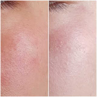 una님이 올린 리뷰 사진 2