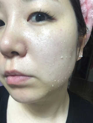 타임인네이처 [더메디닥터] 카렌듈라 엔자임 필링젤 — 5점을 준 리뷰어가 2019년 4월 올린 사용 사진