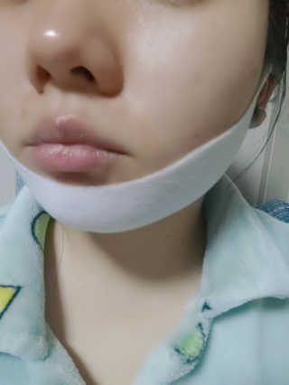 스케덤 클루덤 리프팅 패치 — 1점을 준 리뷰어가 2019년 3월 올린 사용 사진