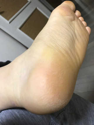 베베풋 글라스 베베풋글라스 — 5점을 준 리뷰어가 2019년 2월 올린 사용 사진