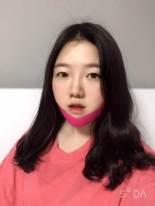 스케덤 펩타이드 리프팅밴드 — 4점을 준 리뷰어가 2019년 3월 올린 사용 사진
