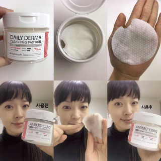 나이팅게일 데일리 더마 클렌징패드 마일드 — 4.83점을 준 리뷰어가 2018년 2월 올린 사용 사진