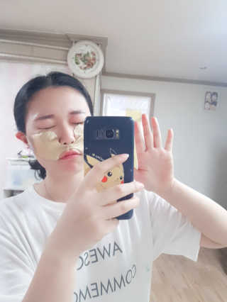 [스케덤] 상악밴드 — 5점을 준 리뷰어가 2019년 6월 올린 사용 사진