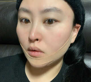 아이디플라코스메틱 아이디 페이스핏 마이너스 밴드 — 5점을 준 리뷰어가 2020년 1월 올린 사용 사진