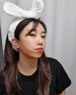 아이디플라코스메틱 아이디 페이스핏 마이너스 밴드 — 5점을 준 리뷰어가 2020년 1월 올린 사용 사진