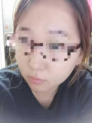 다슈코리아 다슈 안티 헤어로스 헤어쿠션 16g — 4점을 준 리뷰어가 2017년 11월 올린 사용 사진