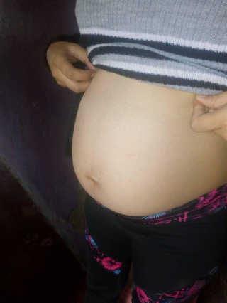 아토팜 Atopalm Maternity Care 마사지 오일 — 5점을 준 리뷰어가 2019년 5월 올린 사용 사진