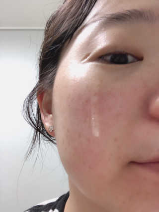 씨엘포 맥스 히아루로닉 프로폴리스 앰플 — 4점을 준 리뷰어가 2019년 5월 올린 사용 사진