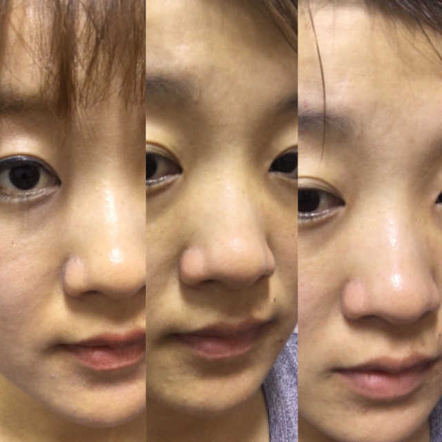 리치마스크팩 리뷰 사진