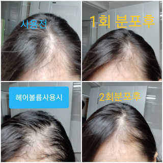 바로티나 [리뷰 상품권 이벤트] 즉시 굵어지는 헤어볼륨S — 5점을 준 리뷰어가 2019년 10월 올린 사용 사진