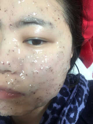 23years old 아쿠아밥 모델링 마스크 — 5점을 준 리뷰어가 2018년 3월 올린 사용 사진